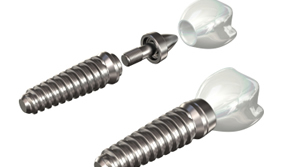 https://yigitdis.com/en/wp-content/uploads/2023/04/implant5.jpg